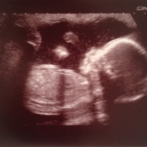 A letter to my unborn son artwork